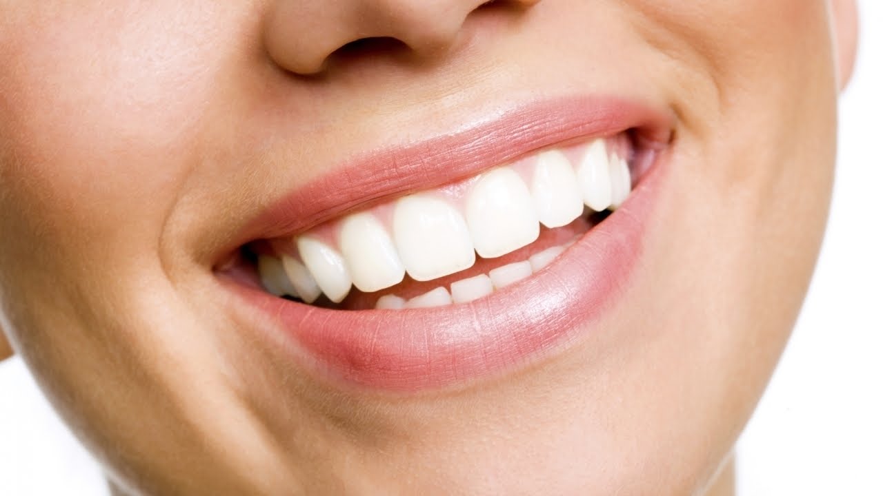 Teeth Whitening in Newmarket Ontario : Upper Canada Dental