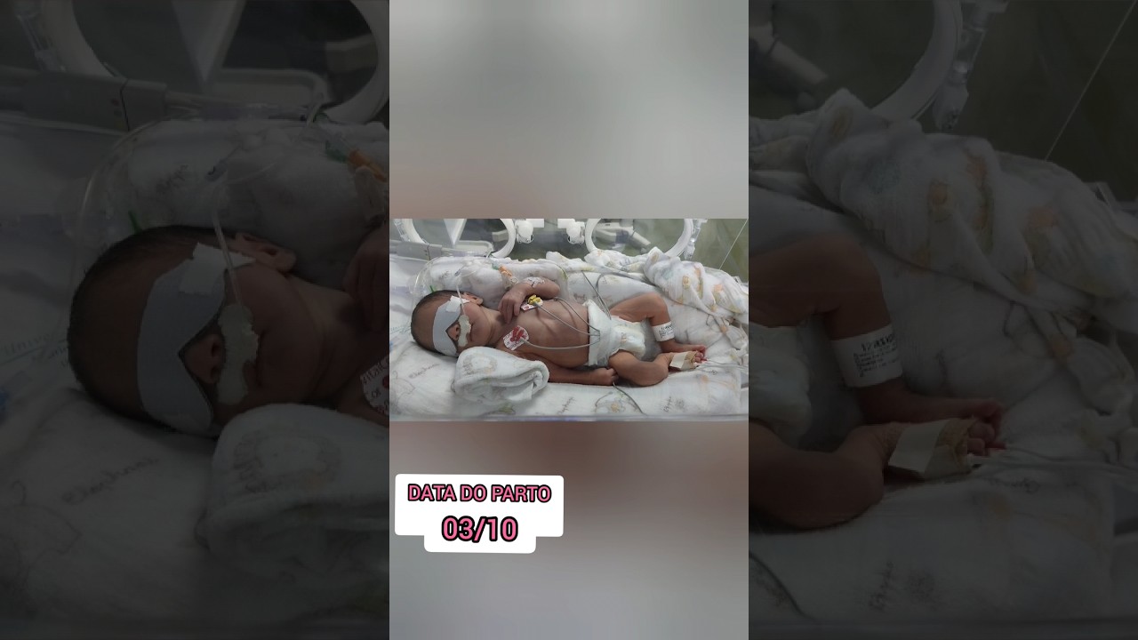 Beb&ecirc; prematuro 34 semanas 🥹