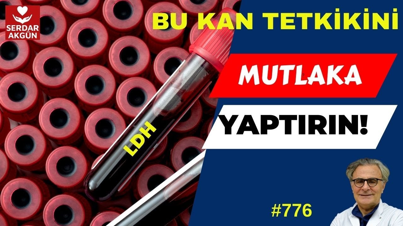 776. Kan Tetkiki, LDH,  LDH yüksekliği, Sağlık, Prof.Dr.Serdar Akgün, Tıp Videoları