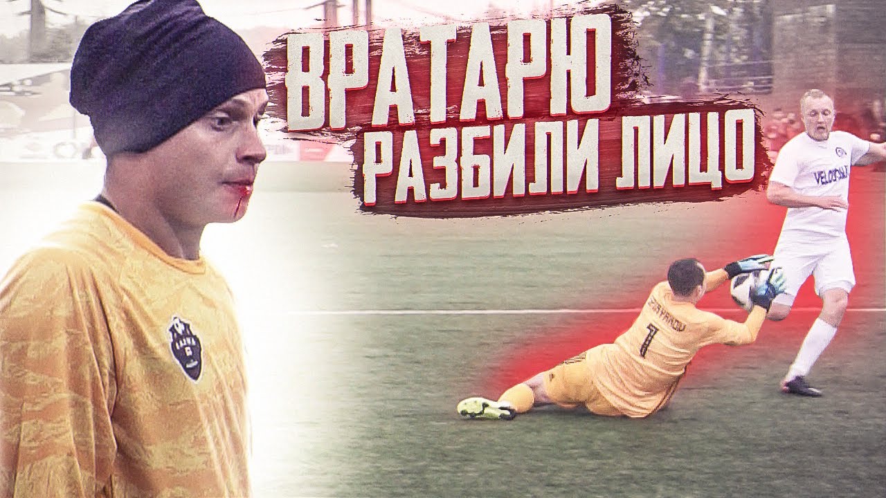 ХУДШИЙ МАТЧ ВРАТАРЕЙ АМКАЛА ||  ТРАВМА ФЕДОСА
