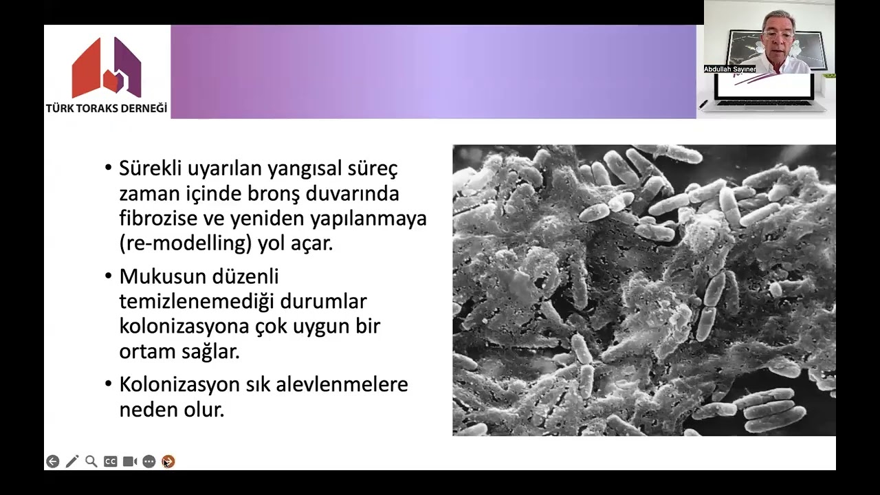 Balgam Tanımlayan Hastaya Yaklaşım Dr Abdullah Sayıner