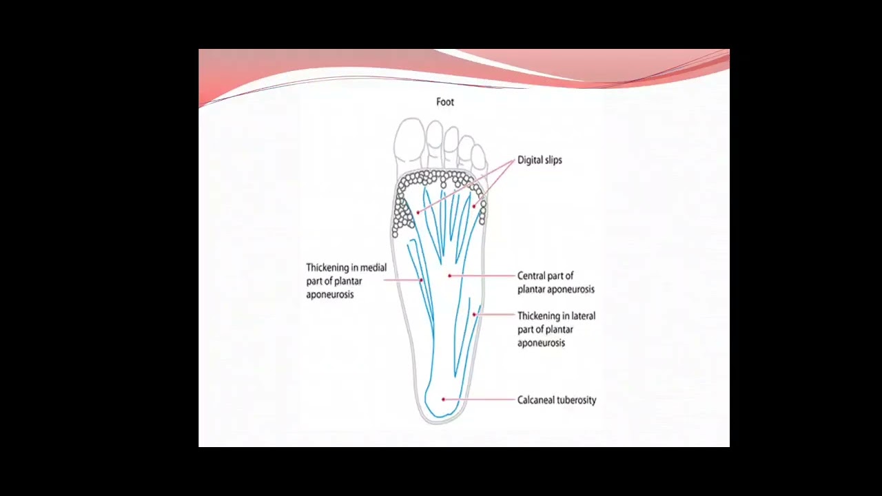 ARCHES OF FOOT