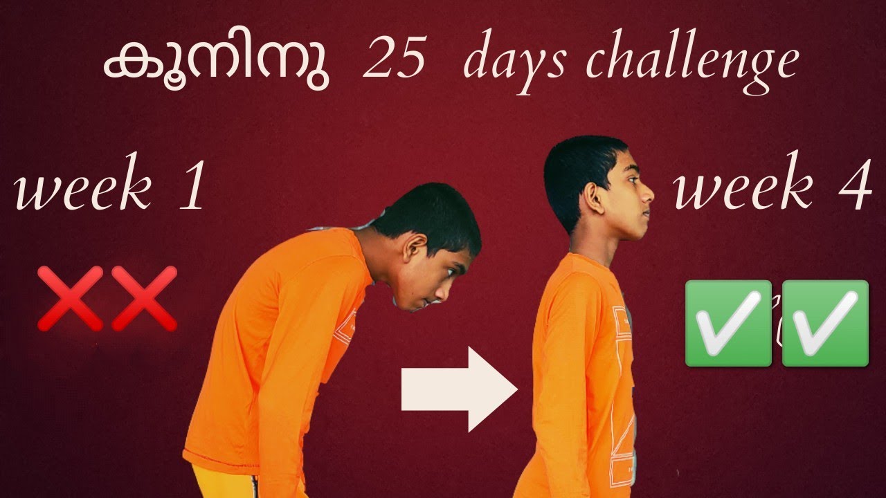 How to remove hunch back simply / കൂൻ എങ്ങനെ മാറ്റം  //  remove bad posture in malayalam.