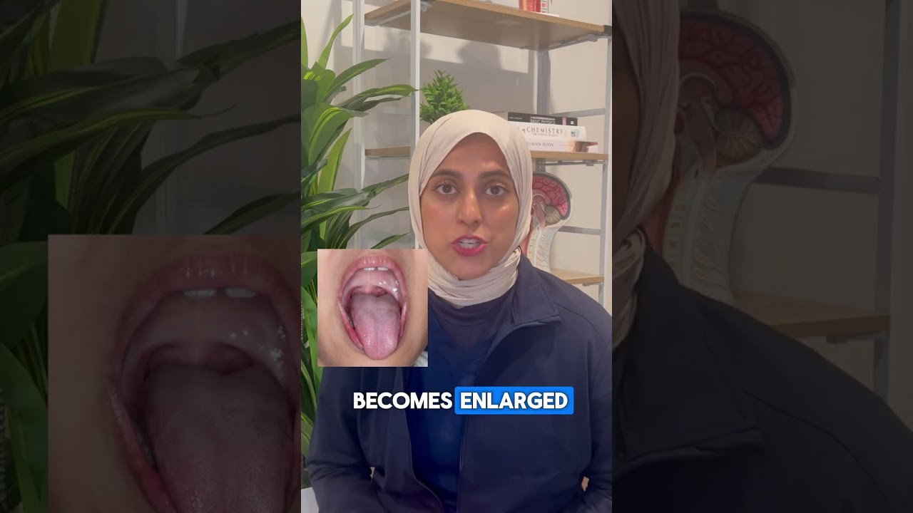 Surgery vs. No Surgery: The Real Cause of Enlarged Adenoids