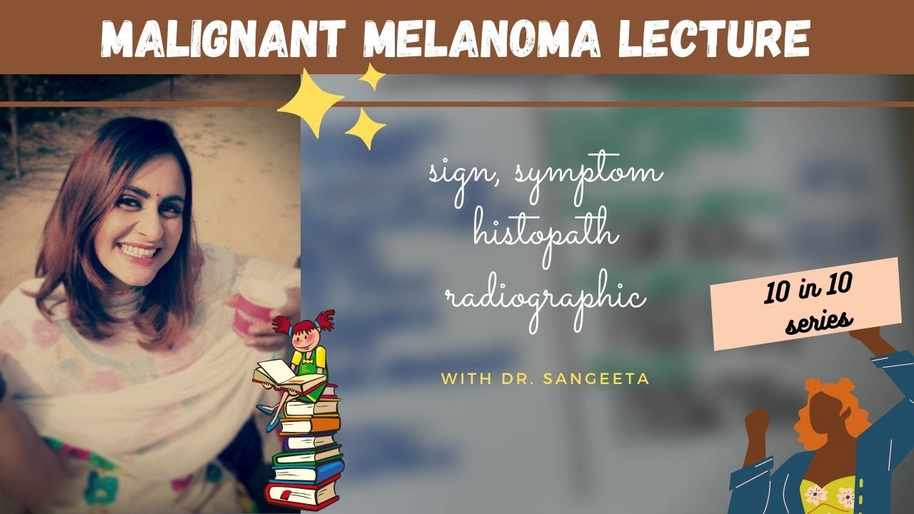 malignant melanoma I dental lectures