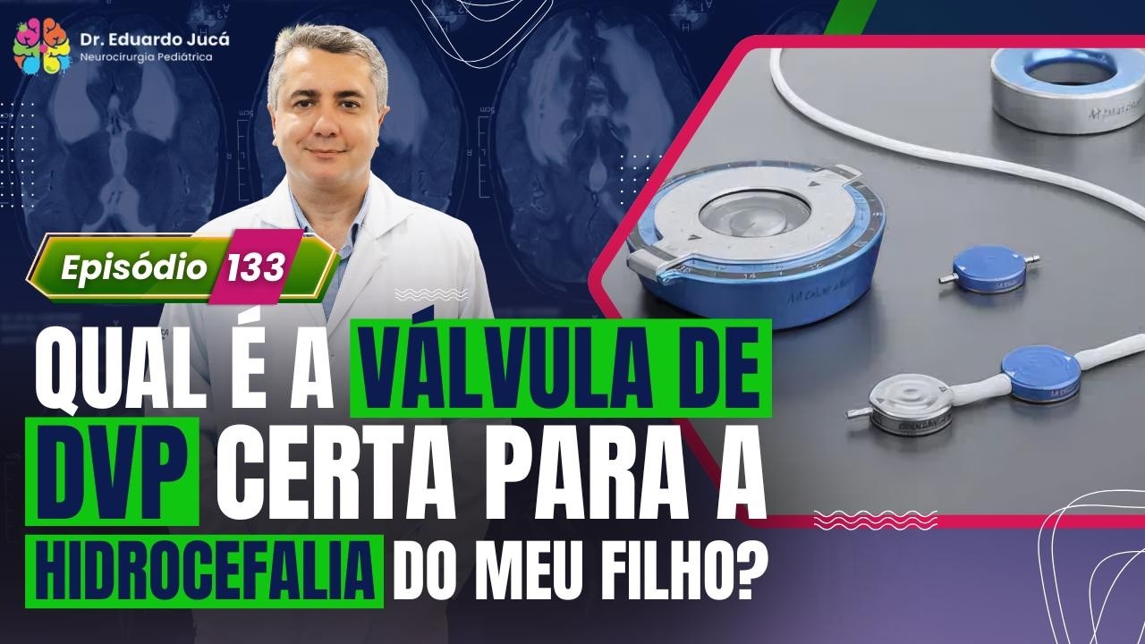 QUAL É A VÁLVULA DE DVP CERTA PARA A HIDROCEFALIA DO MEU FILHO?| EP.: 133