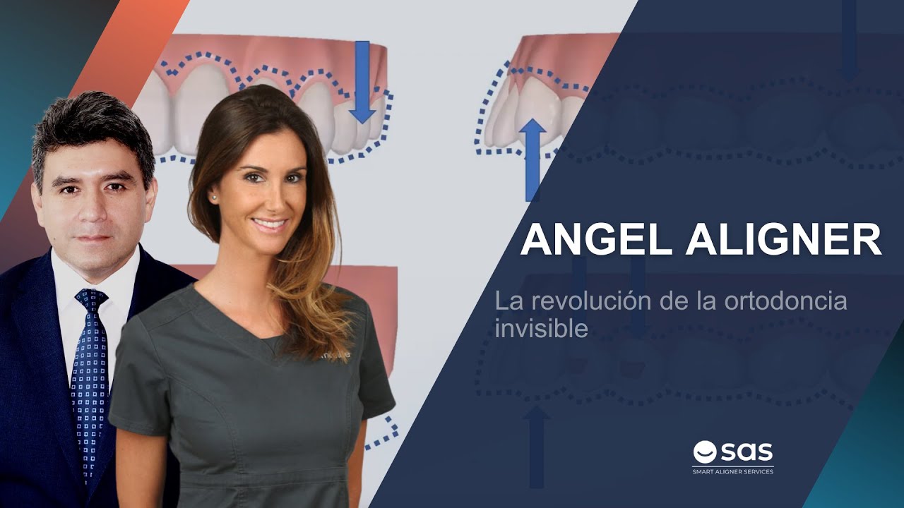 Angel Aligner | La revolución de la ortodoncia invisible