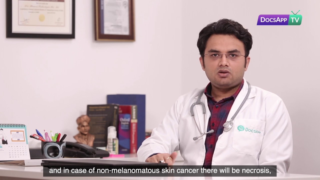 What are the signs and Symptoms of Skin Cancer? #AsktheDoctor