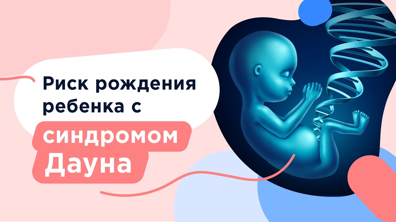 Синдром Дауна: диагностика во время беременности, причины возникновения, симптомы
