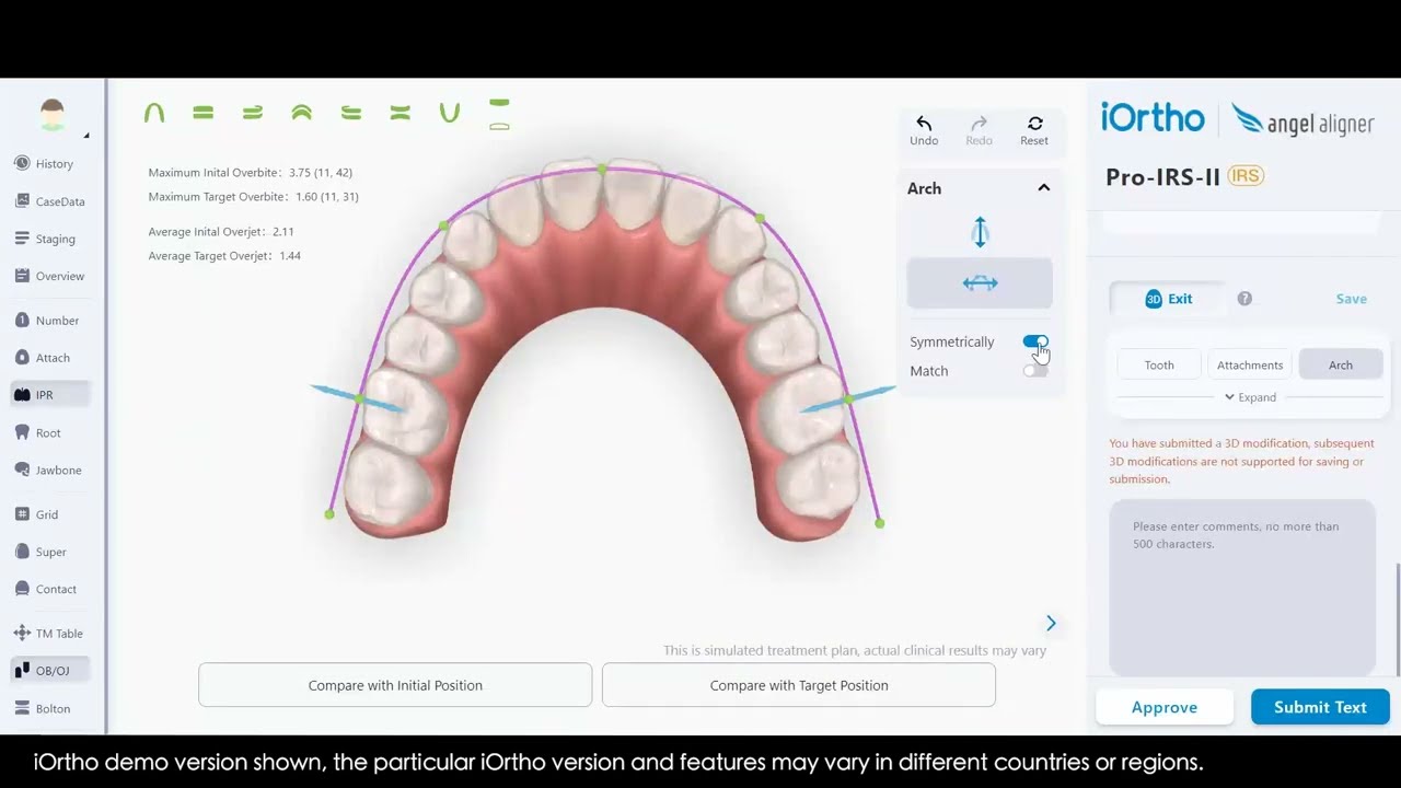 Angel Aligners Workflow Tutorial : Treatment Modifications by iOrtho