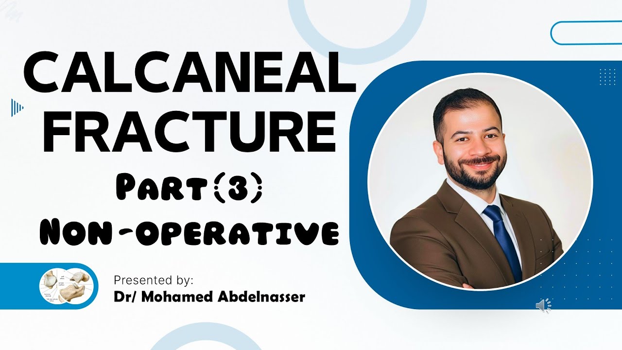 CALCANEAL FRACTURE   |   Part (3)   |   Non-Operative Treatment