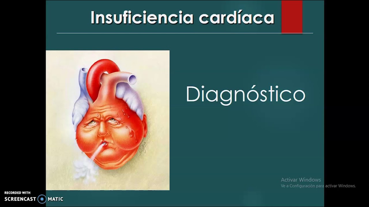 Seminario Insuficiencia Cardíaca - Dr. Pablo Álvarez Rocha