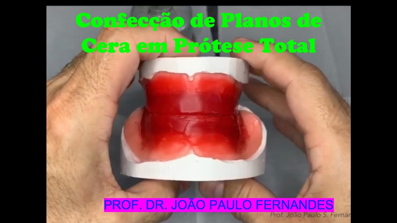 9 - Plano de cera para Prótese Total