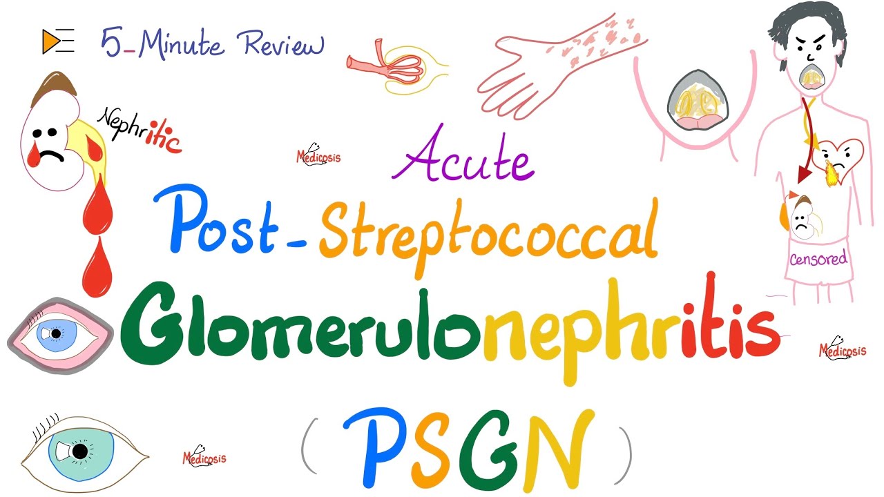 Acute Post-Streptococcal Glomerulonephritis (APSGN) -Nephritic Syndrome -Kidney Pathology-Nephrology