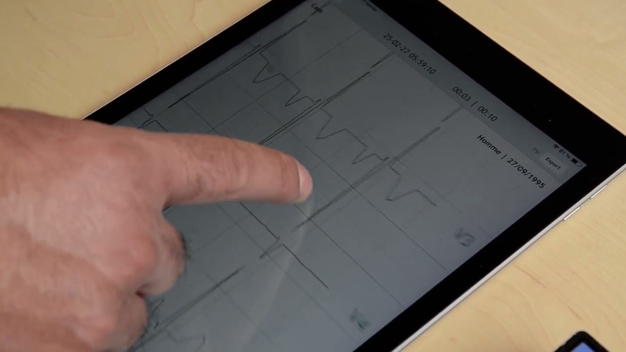 Appareil ECG mobile 12 pistes pour une analyse complète