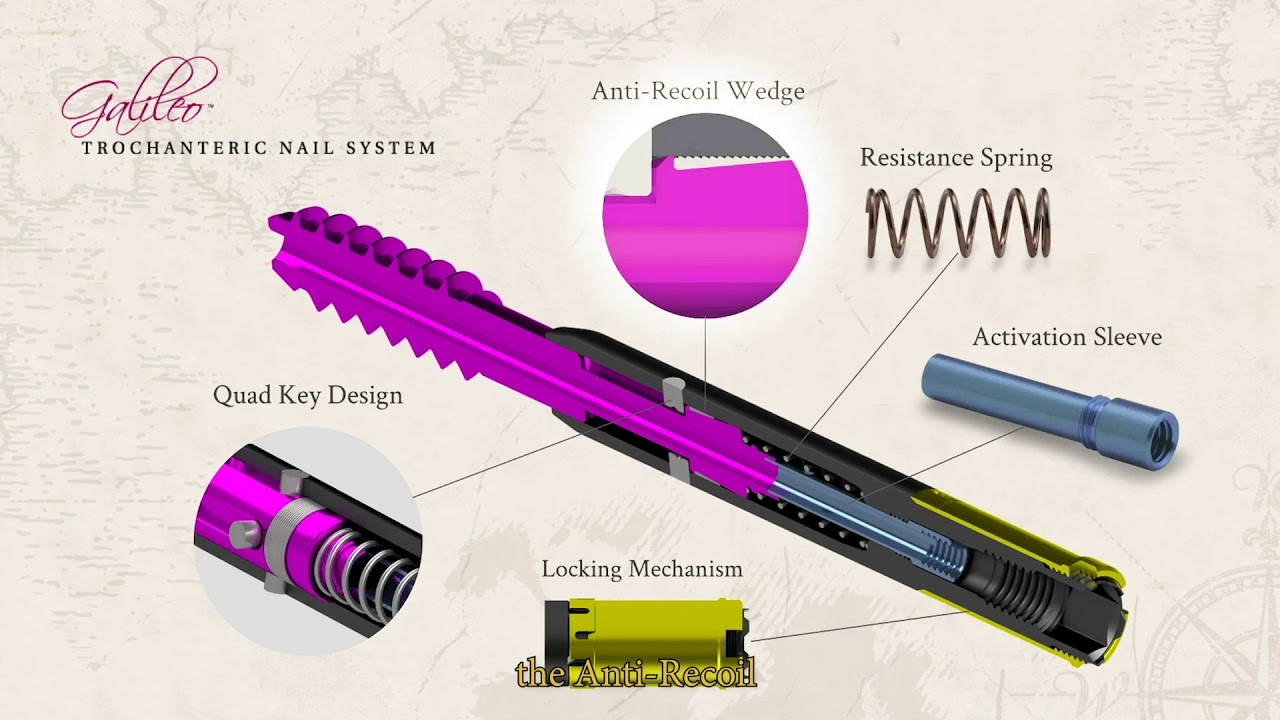 Galileo Part 2: The Galileo Lag Screw