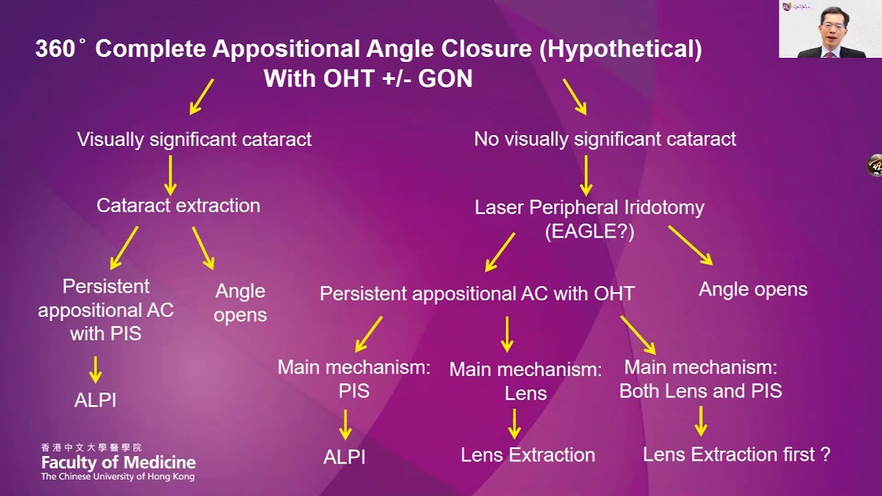 Surgical Options for PACG &ndash; GSL, Micropulse Cyclophotocoagulation, Endoscopic Cyclophotocoagulation