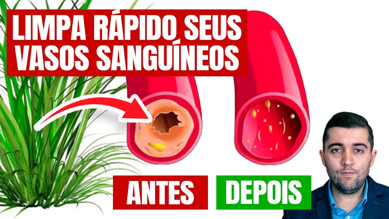 O Poder Oculto do Capim-Lim&atilde;o: Revolucionando a Sa&uacute;de e a Circula&ccedil;&atilde;o com Tratamentos Naturais