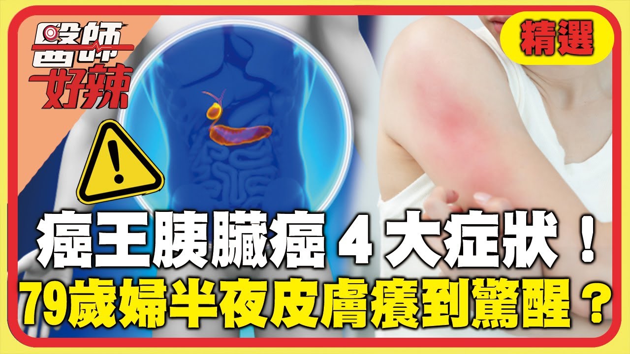「癌王」胰臟癌4大症狀！79歲老婦半夜「皮膚癢」到驚醒？半年內瘦10kg.眼白呈淡黃色竟長2.5cm惡性腫瘤！【#醫師好辣】精選