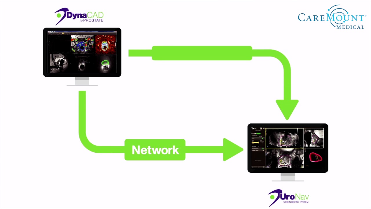 CareMount Medical Introduces UroNav