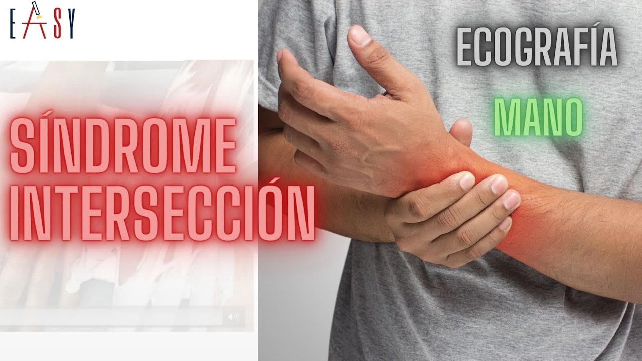 EASY#32 ECOGRAFÍA DE LA MANO Y SÍNDROME DE INTERSECCIÓN.