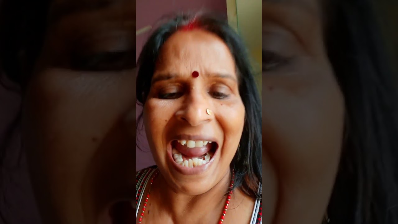 Aaj teath me dard thdocter paas gy or patidev ko teeth nikal dey unka dard th