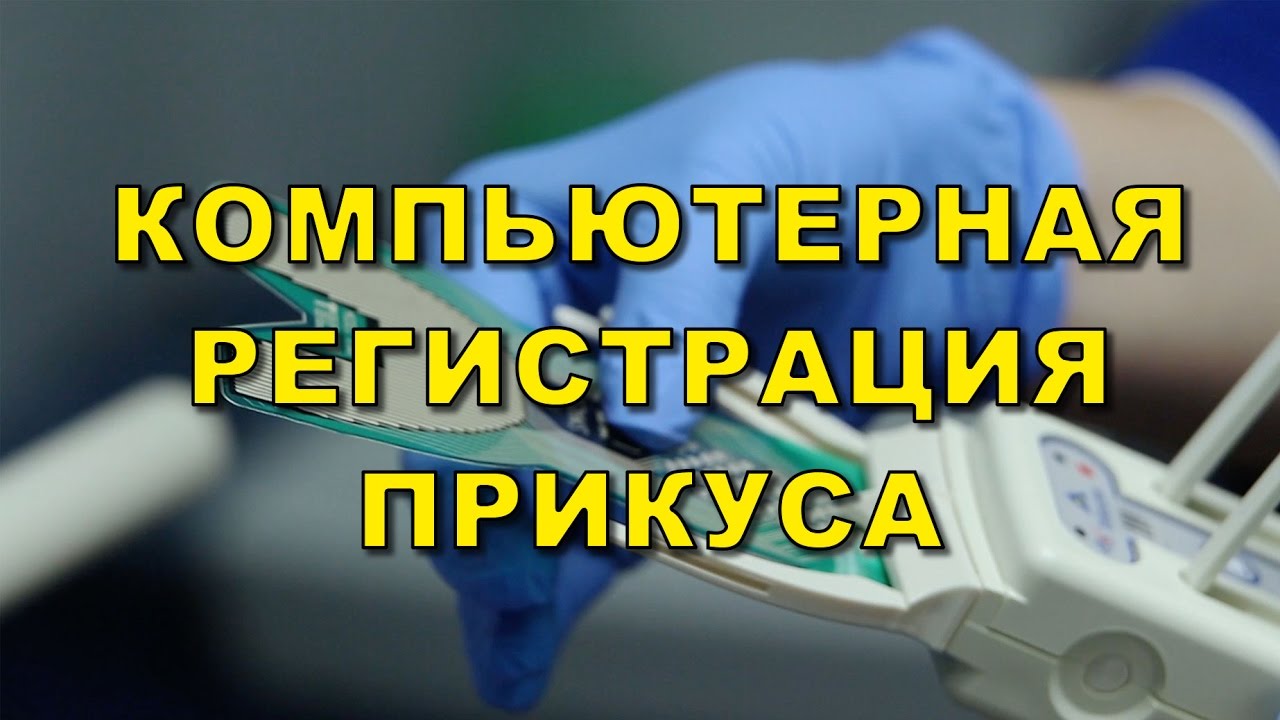 Компьютерная диагностика состояния прикуса T-SCAN.  Клиника Люми-Дент, Киев