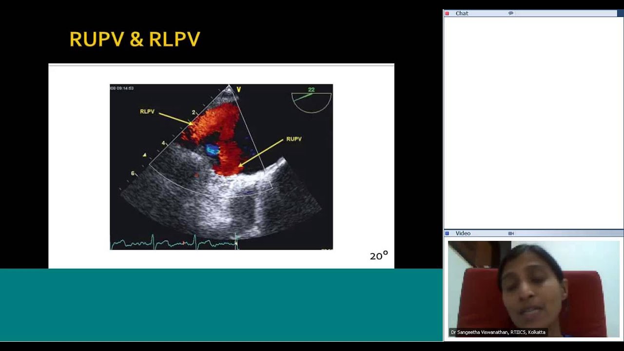 TEE views by Dr Sangeetha