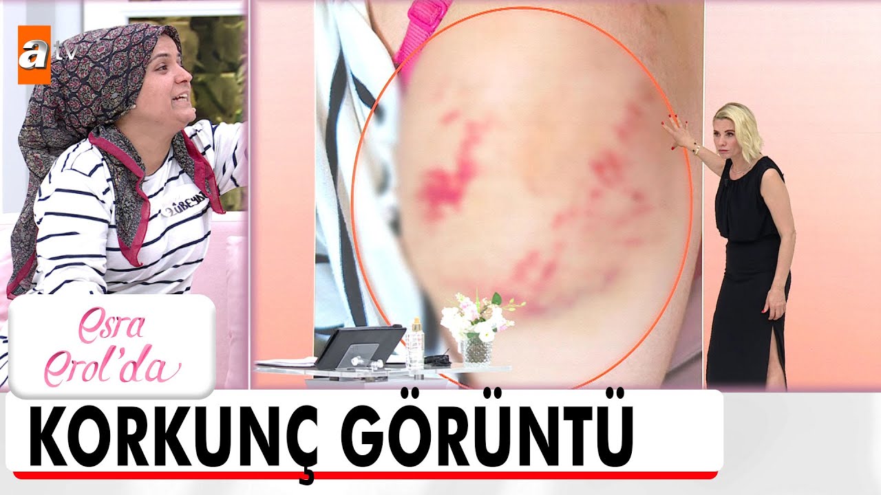 Kayıp Zübeyde bulundu, gerçek ortaya çıktı! - Esra Erol'da