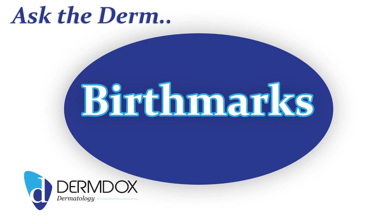 Ask the Derm - What makes birthmarks?