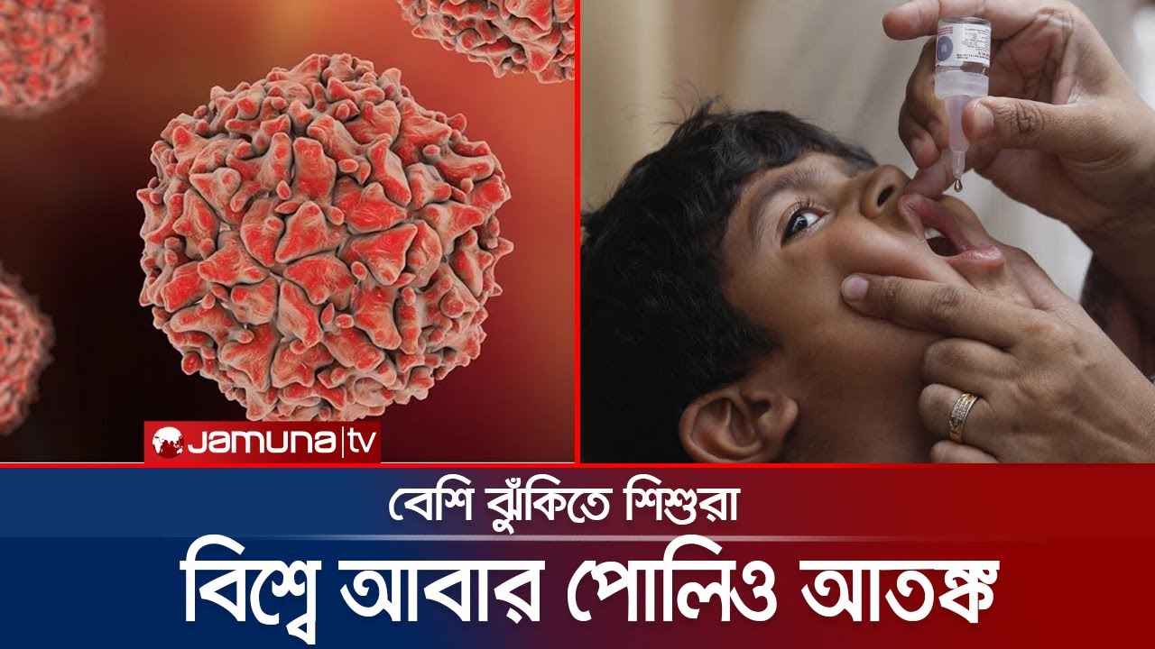 নিউইয়র্ক-লন্ডন-জেরুজালেমে মাথাচাড়া দিচ্ছে পোলিও; বাড়ছে শঙ্কা | Polio