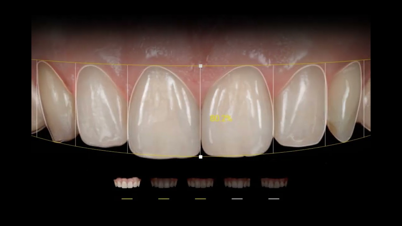 AI curated Smile Design