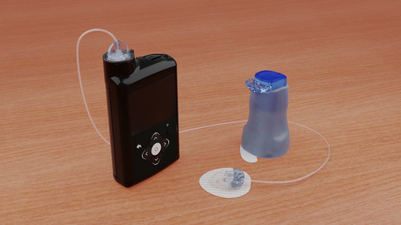 Установка инфузионного набора Medtronic Extended™