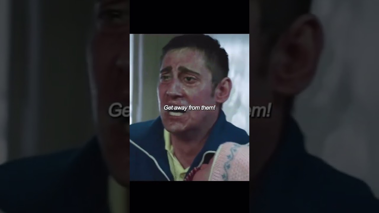 These are radiation burns 🥶🔥 Chernobyl Miniseries #chernobyl #movie #shorts