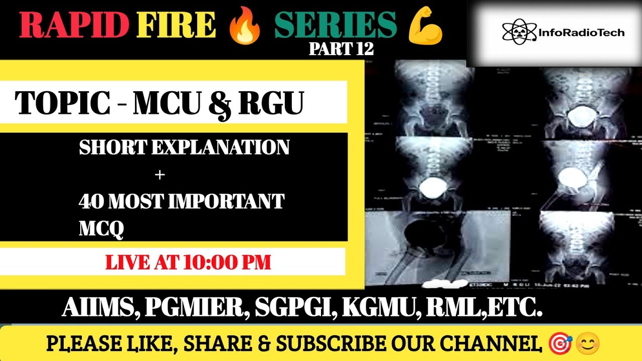 MCU & RGU Explained | Full Radiography Procedure + 40 Most Important MCQs | Rapid Fire 🔥 Series