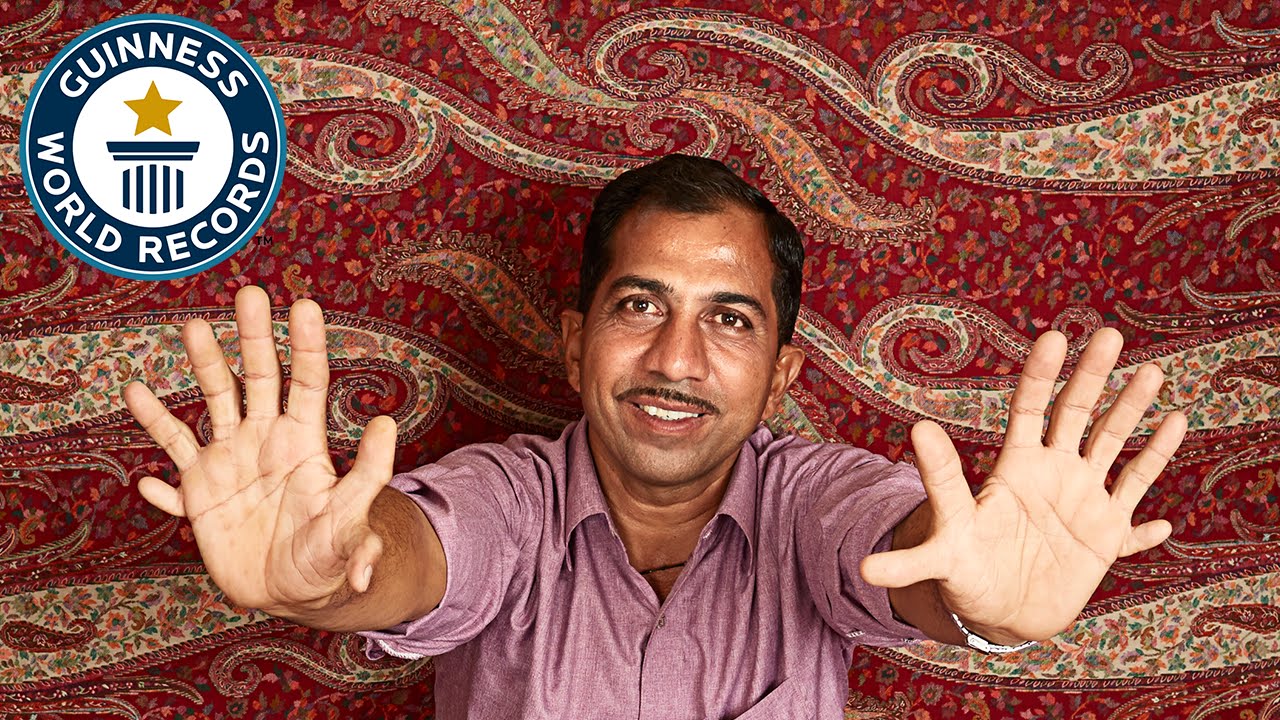 Most fingers and toes on a living person - Guinness World Records