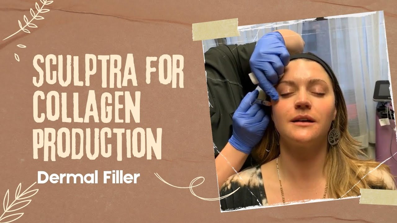 Sculptra for Collagen Production | Dermal Filler | New York, NY | Dr. Jason Emer