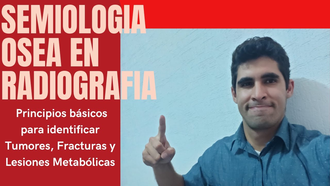 Semiología ósea en radiografía. Principios básicos fracturas, tumores óseos y lesiones metabólicas