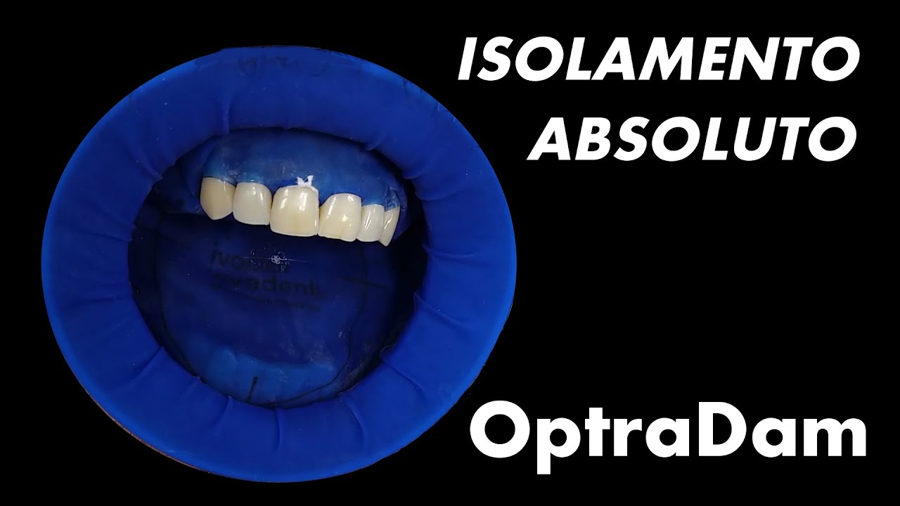 Isolamento Absoluto OptraDam