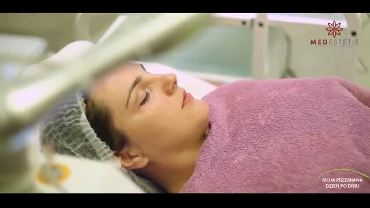 Moja Przemiana - Wizyty Justyny w Instytucie Medycyny Estetycznej MEDESTETIS