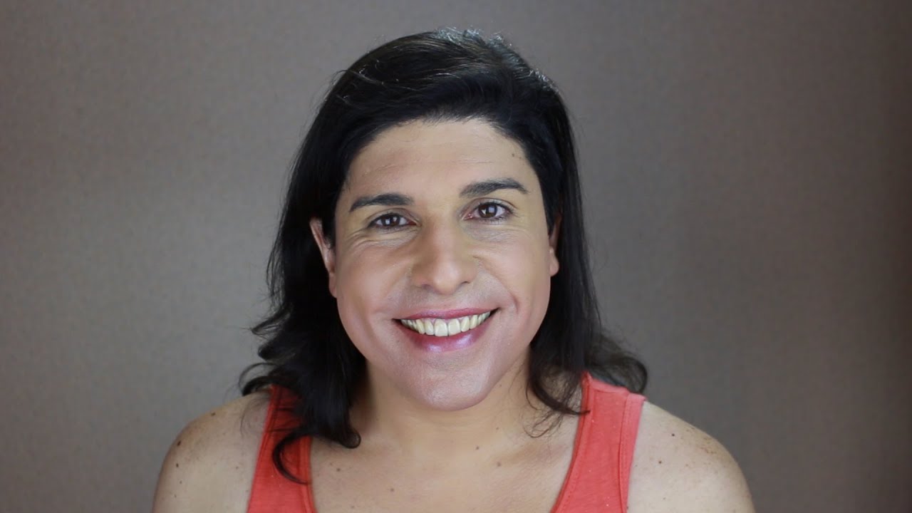 Ask a Trans Woman - Baldness in Trans Women