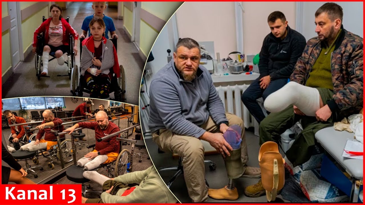 Scale of amputations in Ukraine reaches World War I level