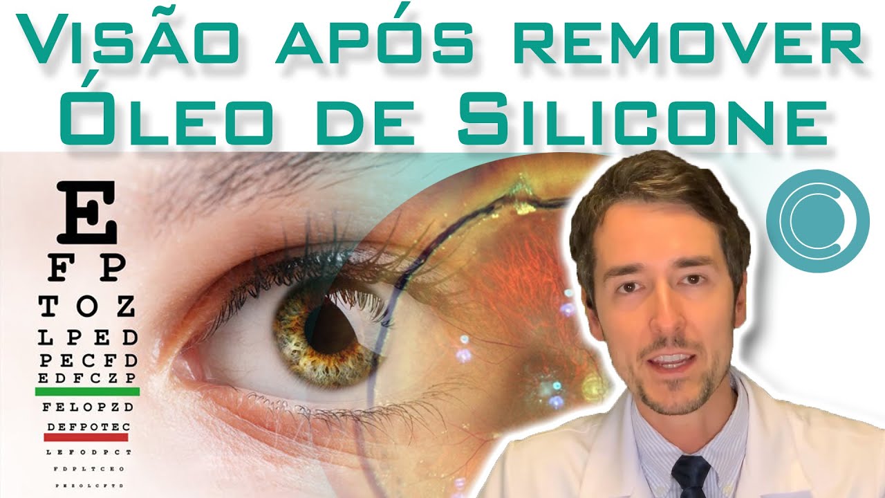 Como é a visão após remover o óleo de silicone ?