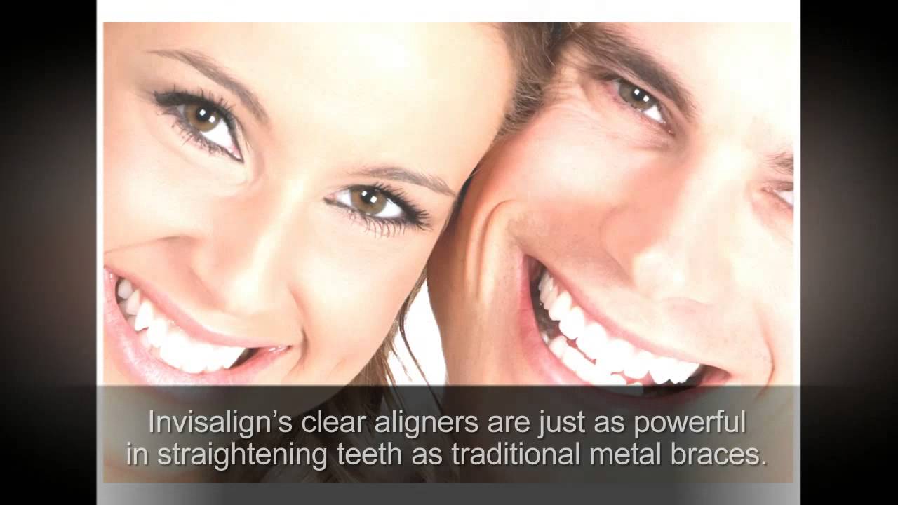 The Benefits of Invisalign in Red Bank | RedBankDentistry.com