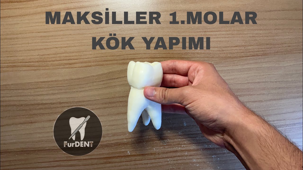 Sabundan Maksiller 1.Molar Diş Yapımı(KÖK BÖLÜMÜ)-Maxillary First Molar-🦷