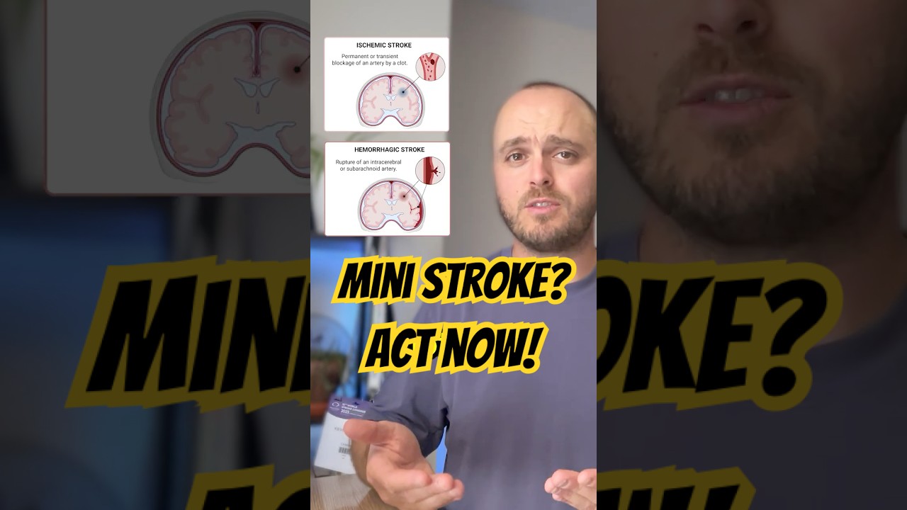 Suffered a mini-stroke? Watch this for one key fact you need to know