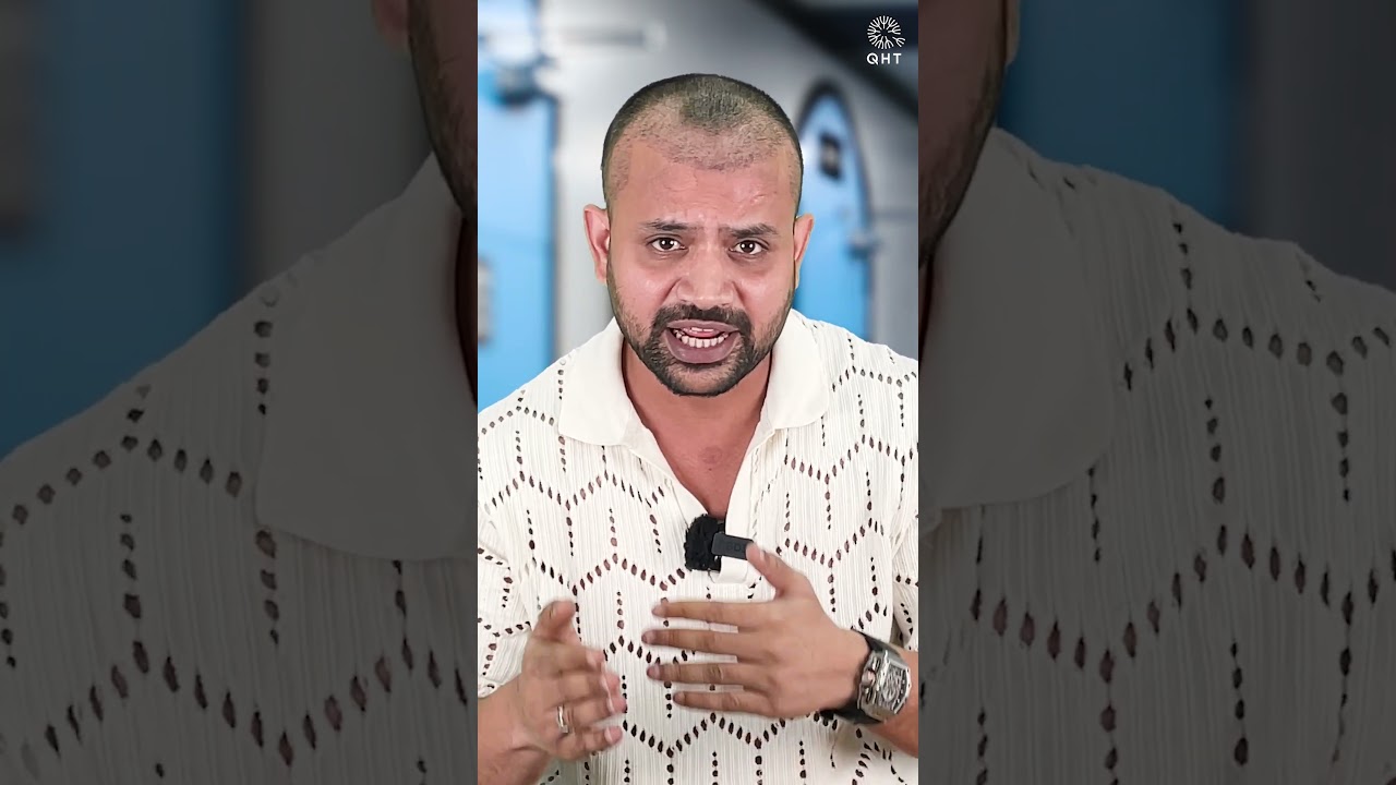 Youtuber Topa Bhai ( Nadeem Bunny ) One Month Hair Transplant Progress #shorts#hairtransplant
