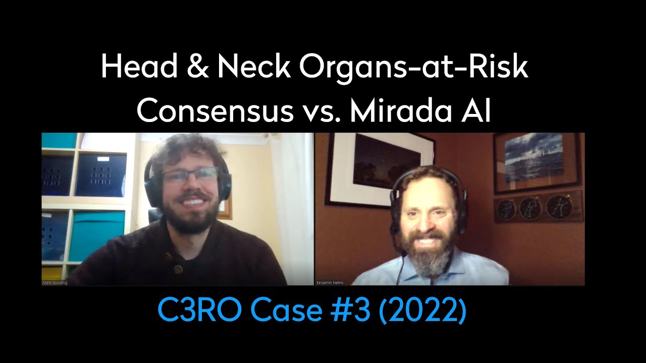 Head & Neck Organs-at-Risk: Consensus vs. Mirada