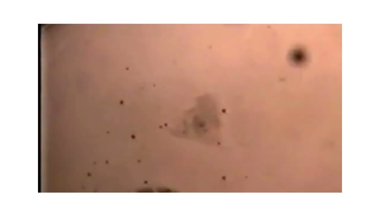 OOCYTE DENUDATION FOR ICSI
