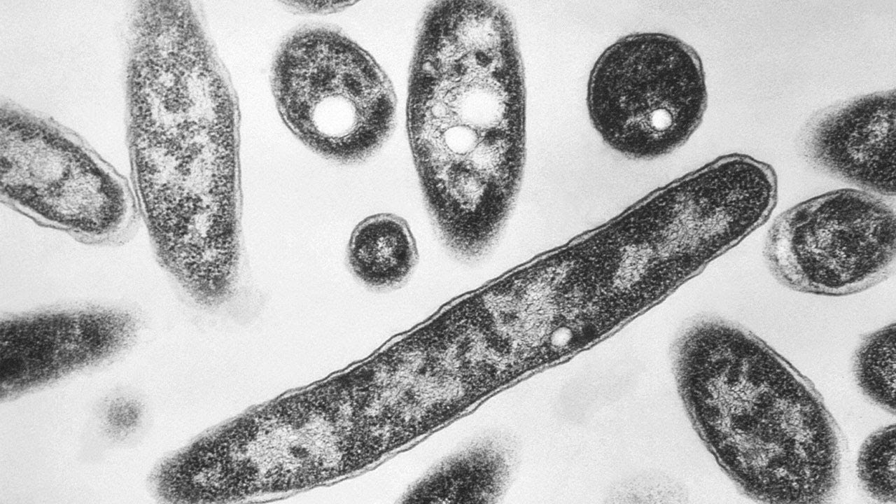 What is Legionnaires' disease?